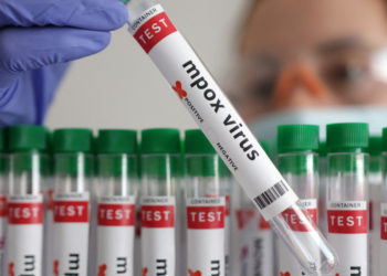 FILE PHOTO: A test tube labelled "Mpox virus positive" is held in this illustration taken August 20, 2024. REUTERS/Dado Ruvic/Illustration/File Photo