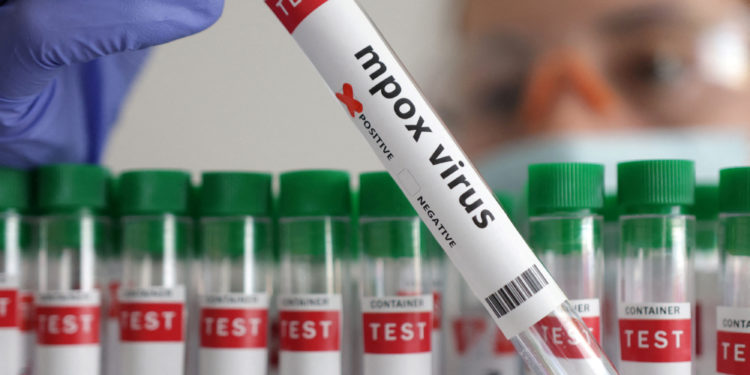 FILE PHOTO: A test tube labelled "Mpox virus positive" is held in this illustration taken August 20, 2024. REUTERS/Dado Ruvic/Illustration/File Photo